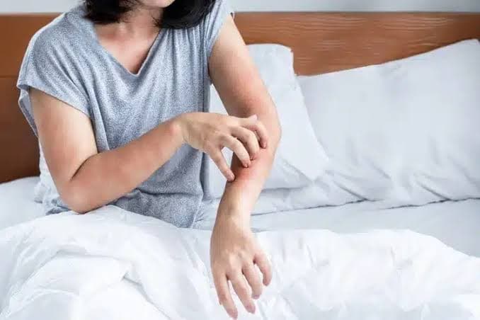 The most common symptoms of dust allergies